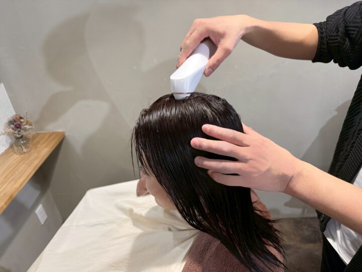 プラズマスカルプマシン施術