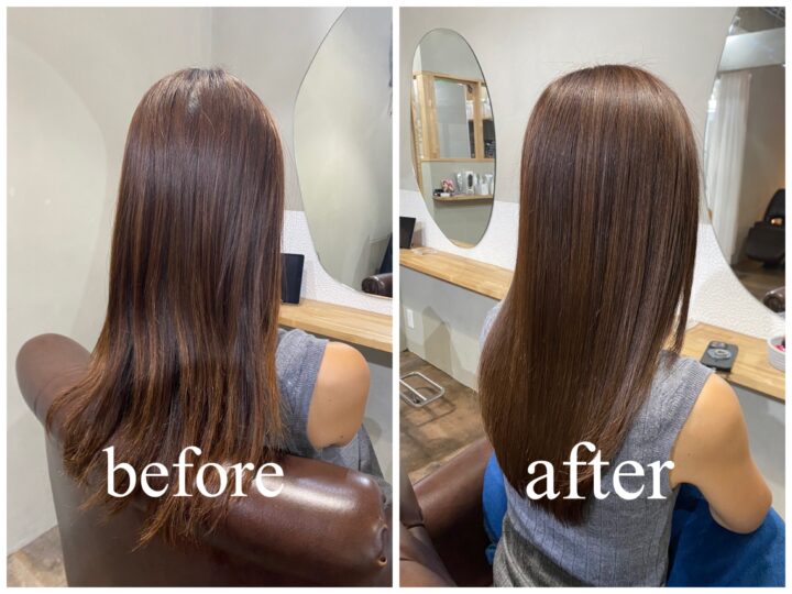 リジェリーケア施術例1